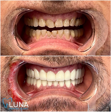 Slider image (6) Luna Dental Clinic